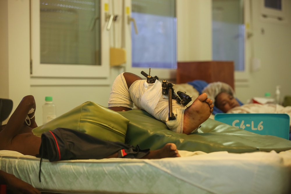 Ein kleiner Junge liegt mit einer Haltevorrichtung für Knochenbrüche am Schienbein in einem Krankenhausbett