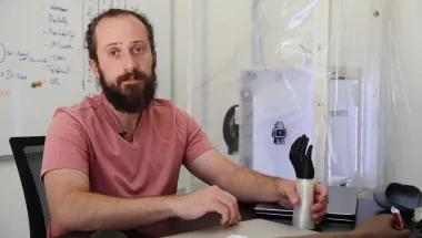 Prothesen 3D printing