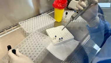 Labor für die Untersuchung von Mykobakterien auf Tuberkulose