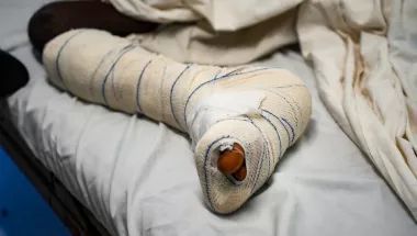 Verbundenes Bein nach Schusswunde.