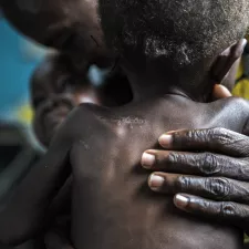 Kongo Mangelernährung Ärzte ohne Grenzen