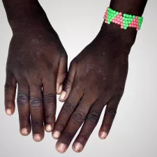 Ärzte ohne Grenzen Niger psychosoziale Hilfe