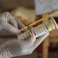 Ein Hepatitis E Test