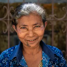 Portrait: Daw Than Than, Bewohnerin des Ghettos Aung Mingalar, Myanmar