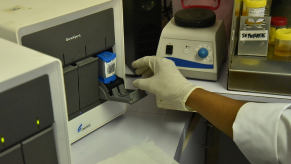 Für eine schnelle TB-Diagnose wird in das Gerät eine Probe eingelegt