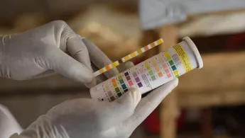 Ein Hepatitis E Test
