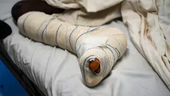 Verbundenes Bein nach Schusswunde.