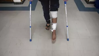 Ein Bein mit externer Fixierung.