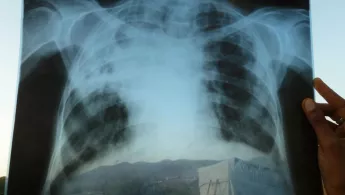 Telemedicine Ethiopia