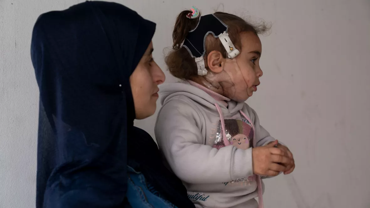 Eine Mutter hält ein Kleinkind im Arm, das eine Maske aus Kunststoff trägt.