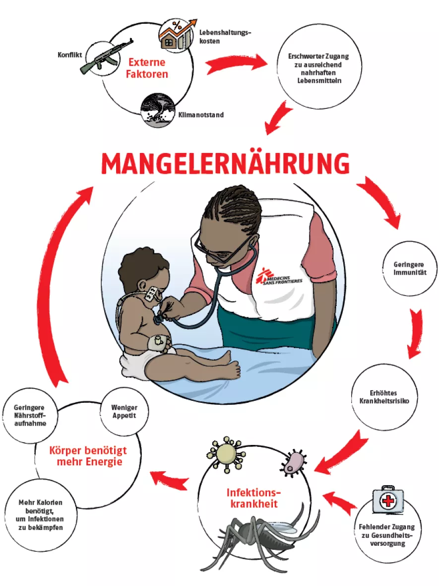 Mangelernährung Grafik