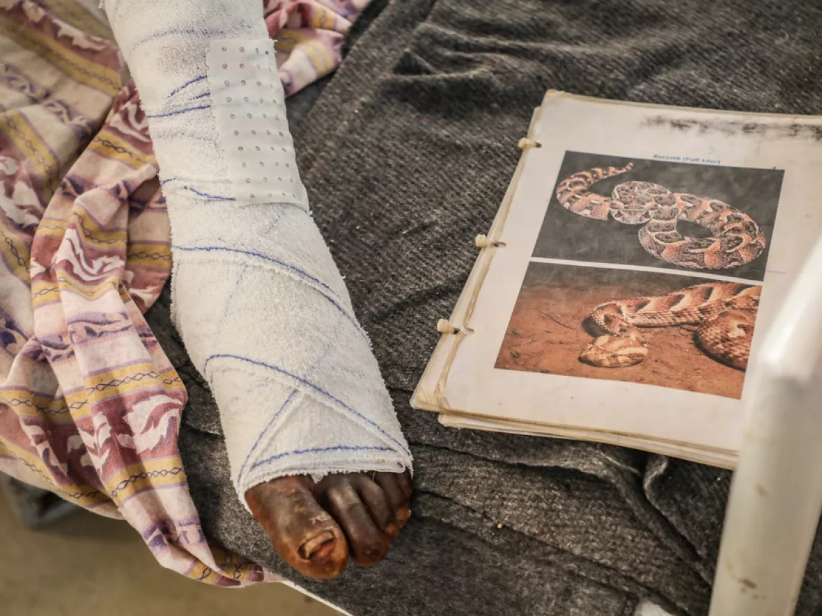 Arop Magut verbundener Fuß