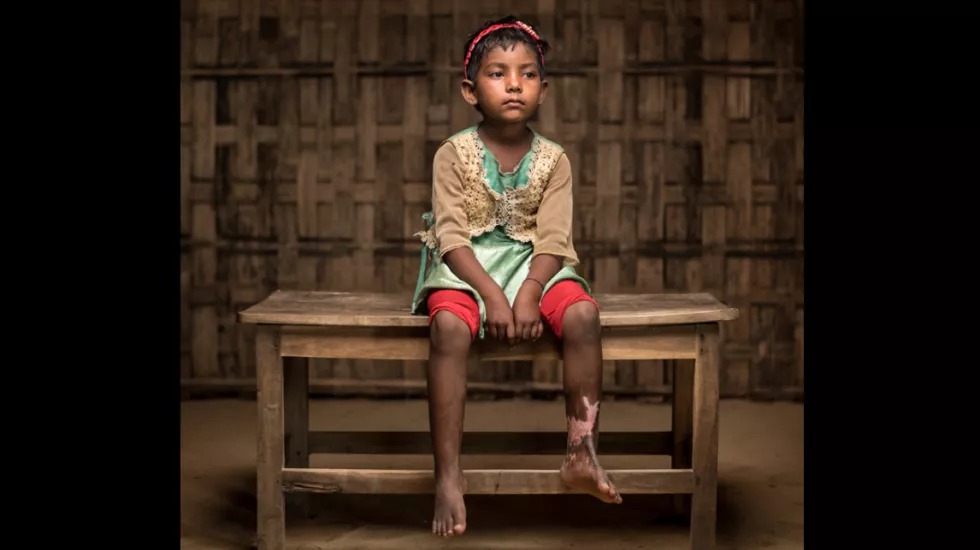 Rohingya Bangladesch Kutupalong Geflüchtete Myanmar Rohingya Bangladesch Kutupalong Geflüchtete Myanmar