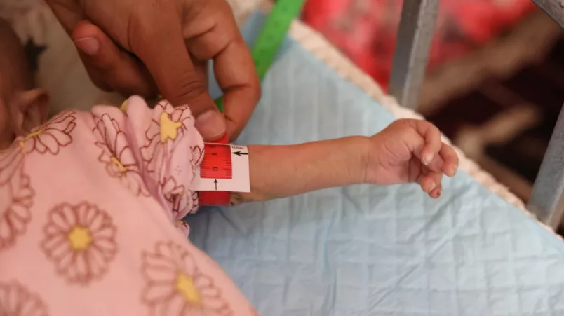 Dieses 5 Monate alte Kind wird wegen akuter Mangelernährung behandelt. Mangelernährung wird mit Messband an Babyarm festgestellt