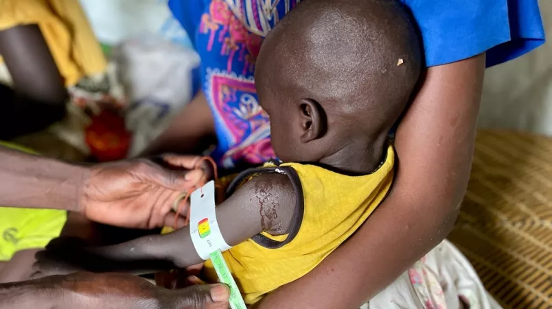 Diagnose von Mangelernährung bei Kleinkind.