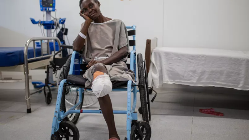 Patientin mit amputiertem Bein in Rollstuhl