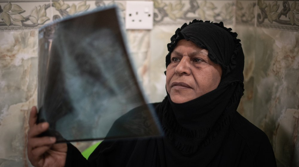 Hameeda Mohammad betrachtet ihre Röntgenaufnahme 