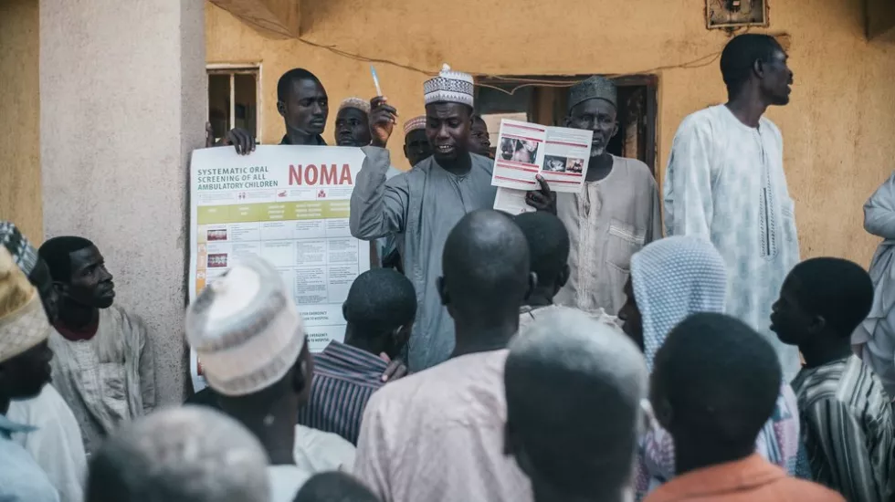Outreach Team informiert Dorf über Noma und Behandlung