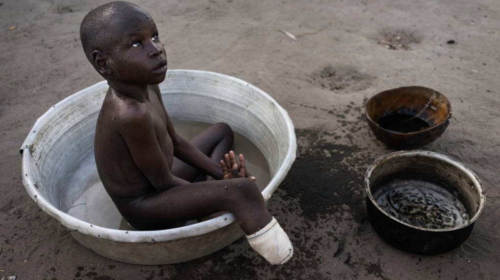 Südsudan Konflikt Gewalt Zerstörung Nahrungsmittel