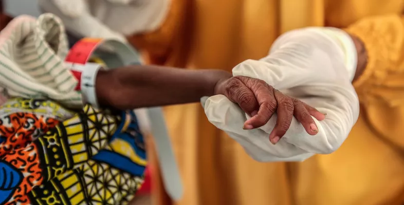 Ein Arzt misst den Arm eines mangelernährten Kindes.