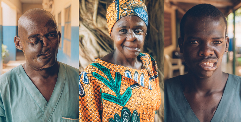 Noma-Überlebende Dahiru Saidu, Mulikat Okanlawon und Muhammadu Usman