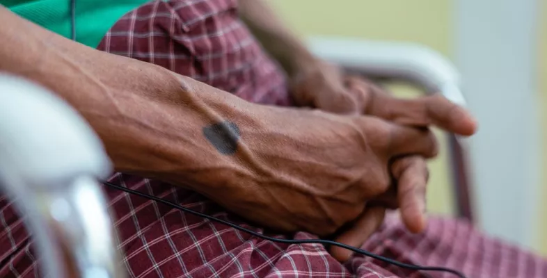 Ein tätowiertes Herz auf der Hand eines Patienten, der in unserer mobilen Klinik behandelt wird. 