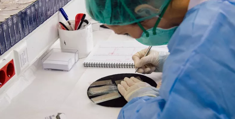 In einem Labor in Nukus, Usbekistan, bereitet eine Labortechnikerin einen Tuberkulose Test vor