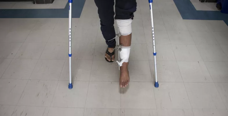 Ein Bein mit externer Fixierung.