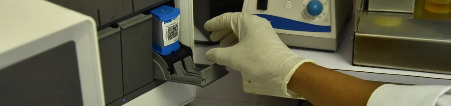 Für eine schnelle TB-Diagnose wird in das Gerät eine Probe eingelegt