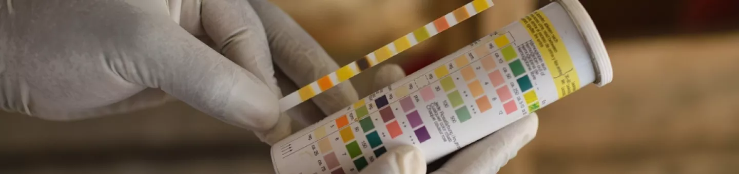 Ein Hepatitis E Test