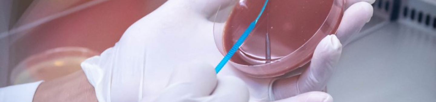 Petrischale mit einem Test auf antimikrobielle Resistenzen