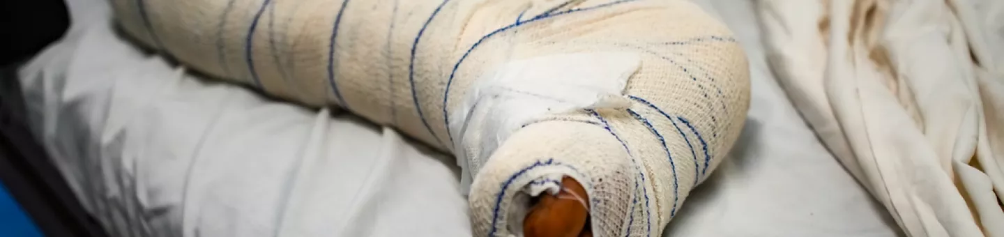 Verbundenes Bein nach Schusswunde.