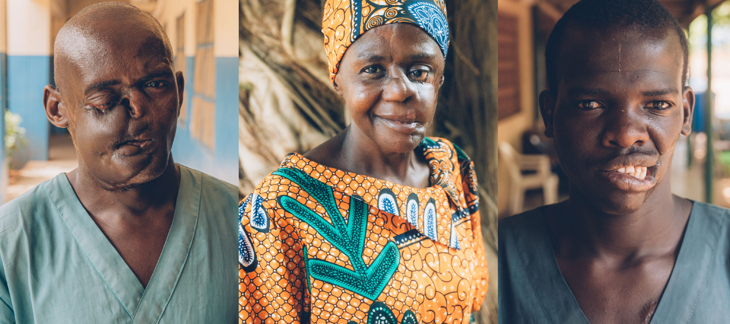 Noma-Überlebende Dahiru Saidu, Mulikat Okanlawon und Muhammadu Usman