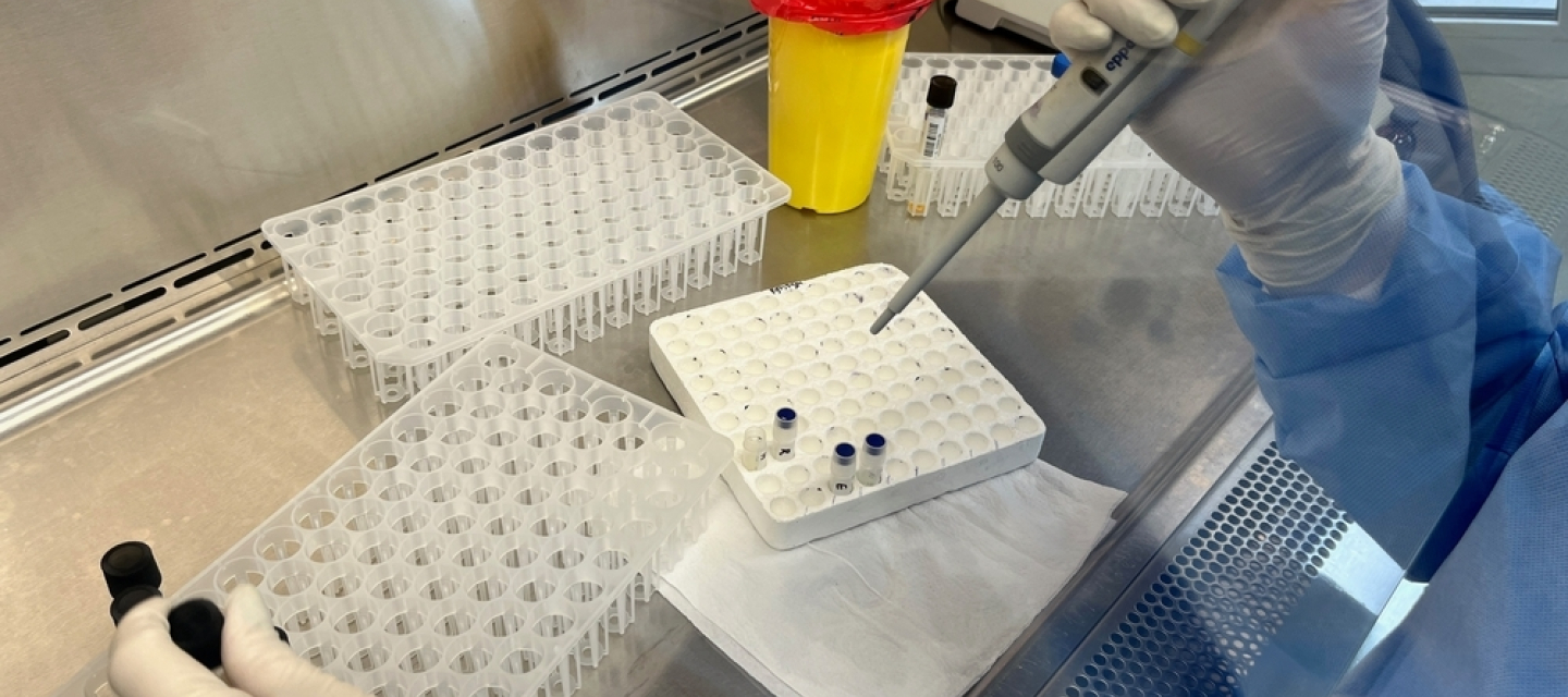 Die Mykobakterium-Tuberkulose-Kultur wird im Labor gegen verschiedene Antibiotika getestet. Das Tragen von Schutzkleidung ist für die Mitarbeiter während dieses Verfahrens obligatorisch. Labor für die Untersuchung von Mykobakterien auf Tuberkulose