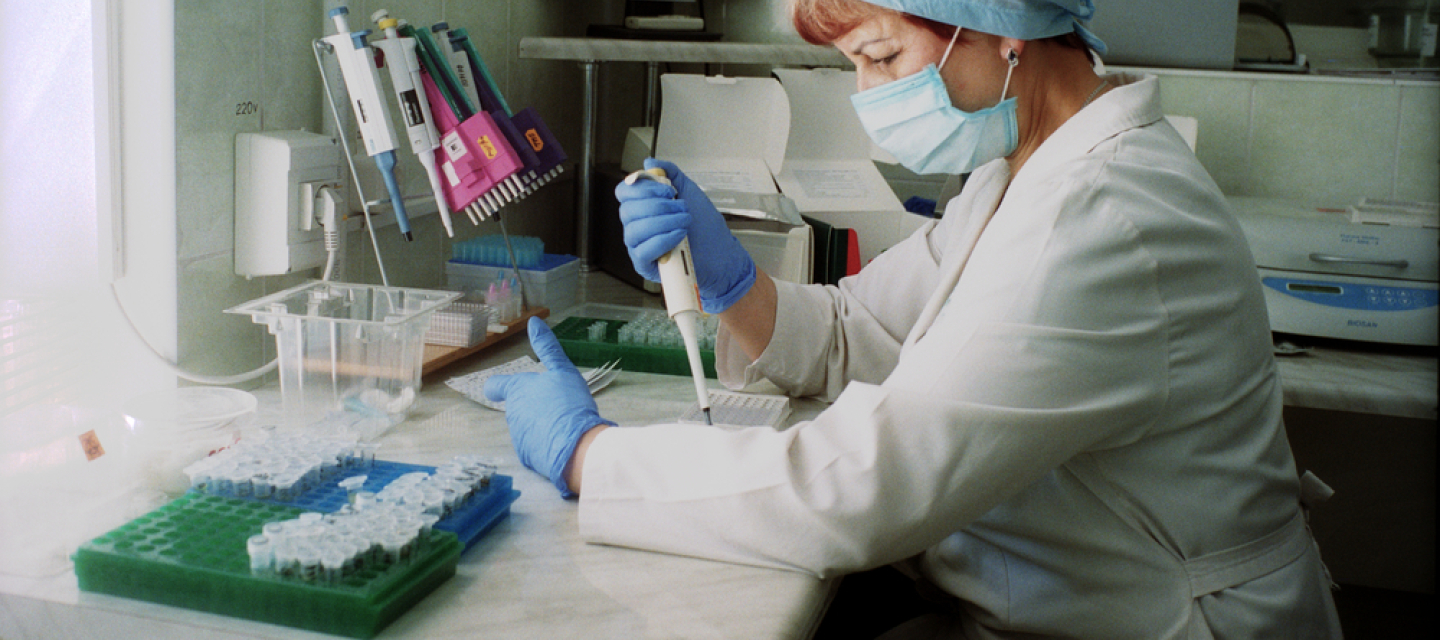 Laborantin untersucht Hepatitis C-Test