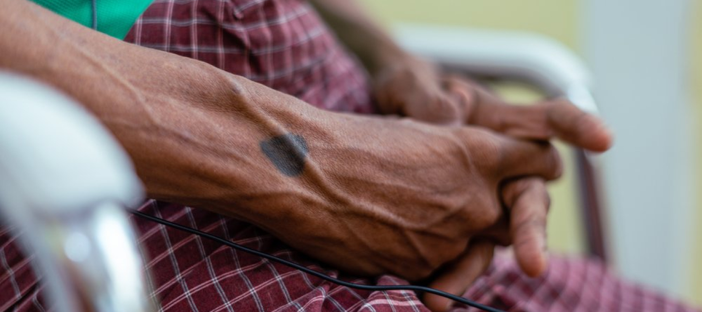 Ein tätowiertes Herz auf der Hand eines Patienten, der in unserer mobilen Klinik behandelt wird. 