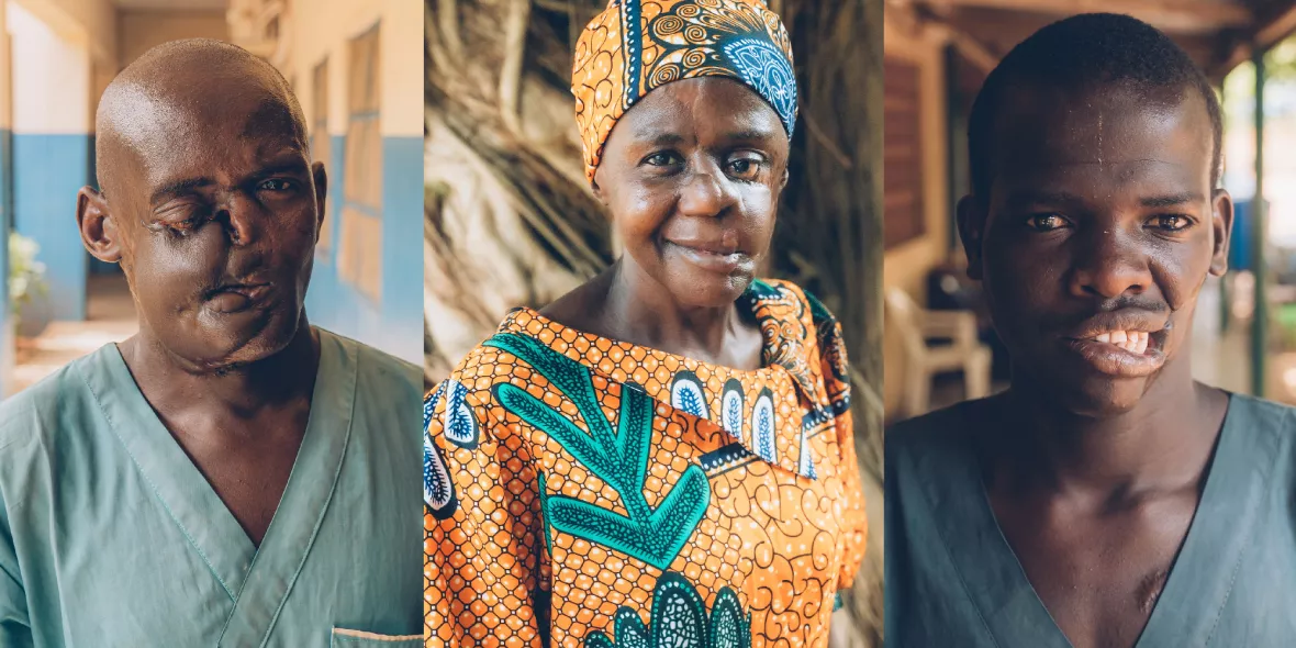 Noma-Überlebende Dahiru Saidu, Mulikat Okanlawon und Muhammadu Usman