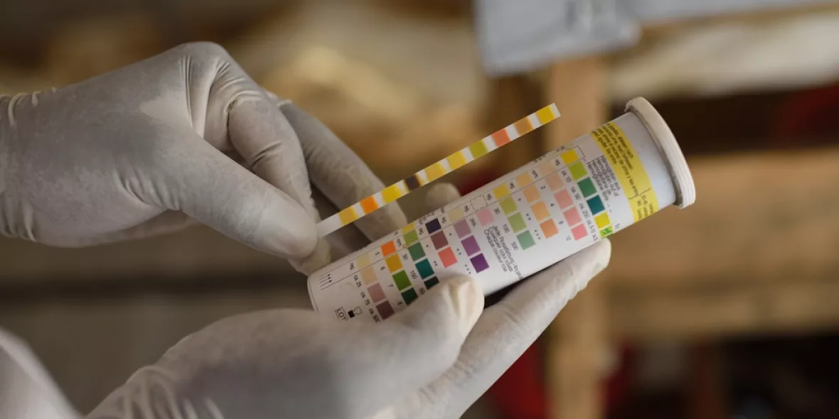 Ein Hepatitis E Test