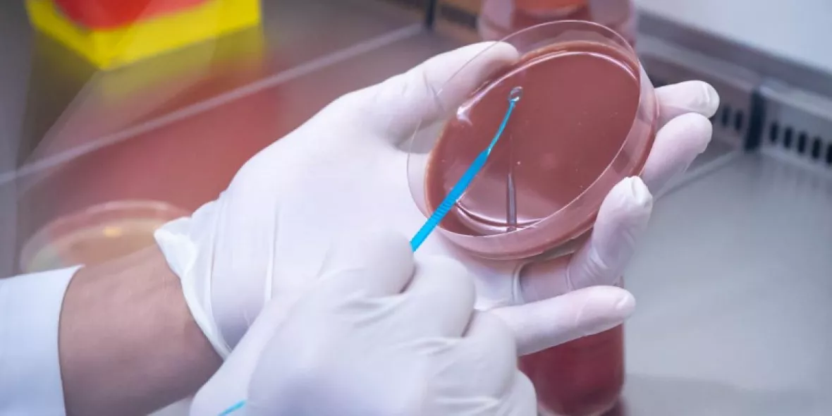 Petrischale mit einem Test auf antimikrobielle Resistenzen