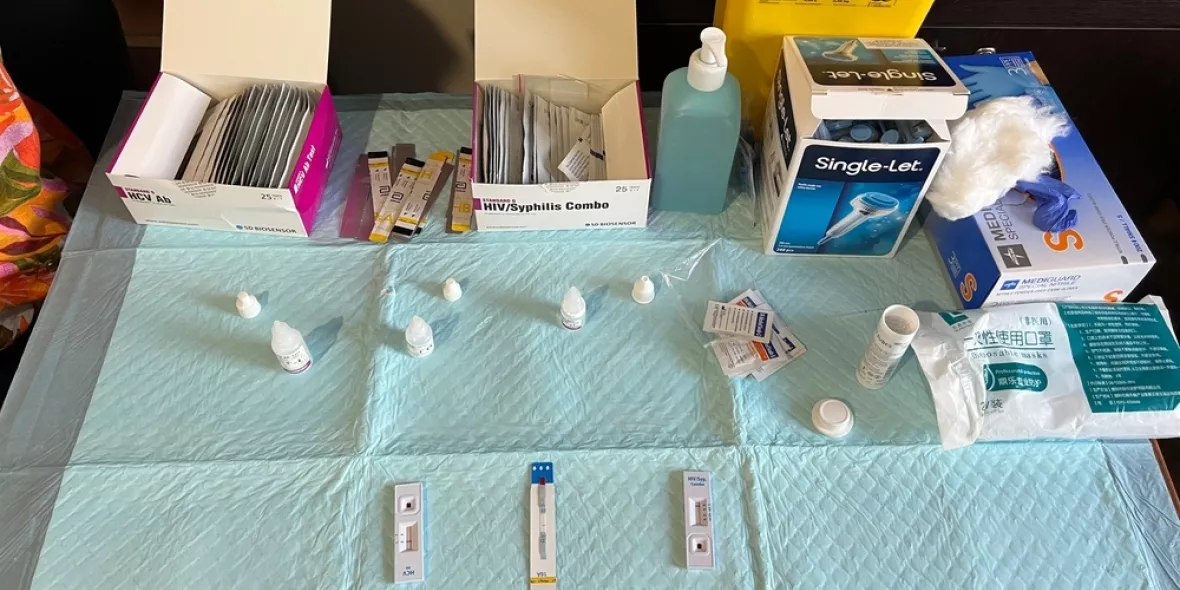 Testmaterial für Hepatitis-C und HIV auf Tisch
