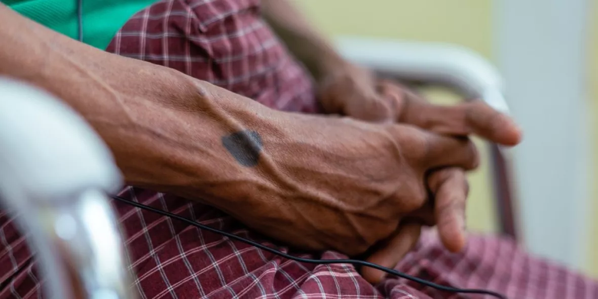 Ein tätowiertes Herz auf der Hand eines Patienten, der in unserer mobilen Klinik behandelt wird. 