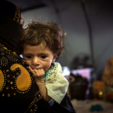 Irak Mossul Säuglinge Babys Mangelernährung