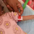 Ärmchen von Kind mit Mangelernährungs-Bändchen