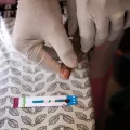 Ärzte ohne Grenzen HIV Medikamentenkampagne
