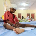 Noma Gesicht Operation Nigeria Junge