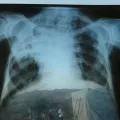 Telemedicine Ethiopia